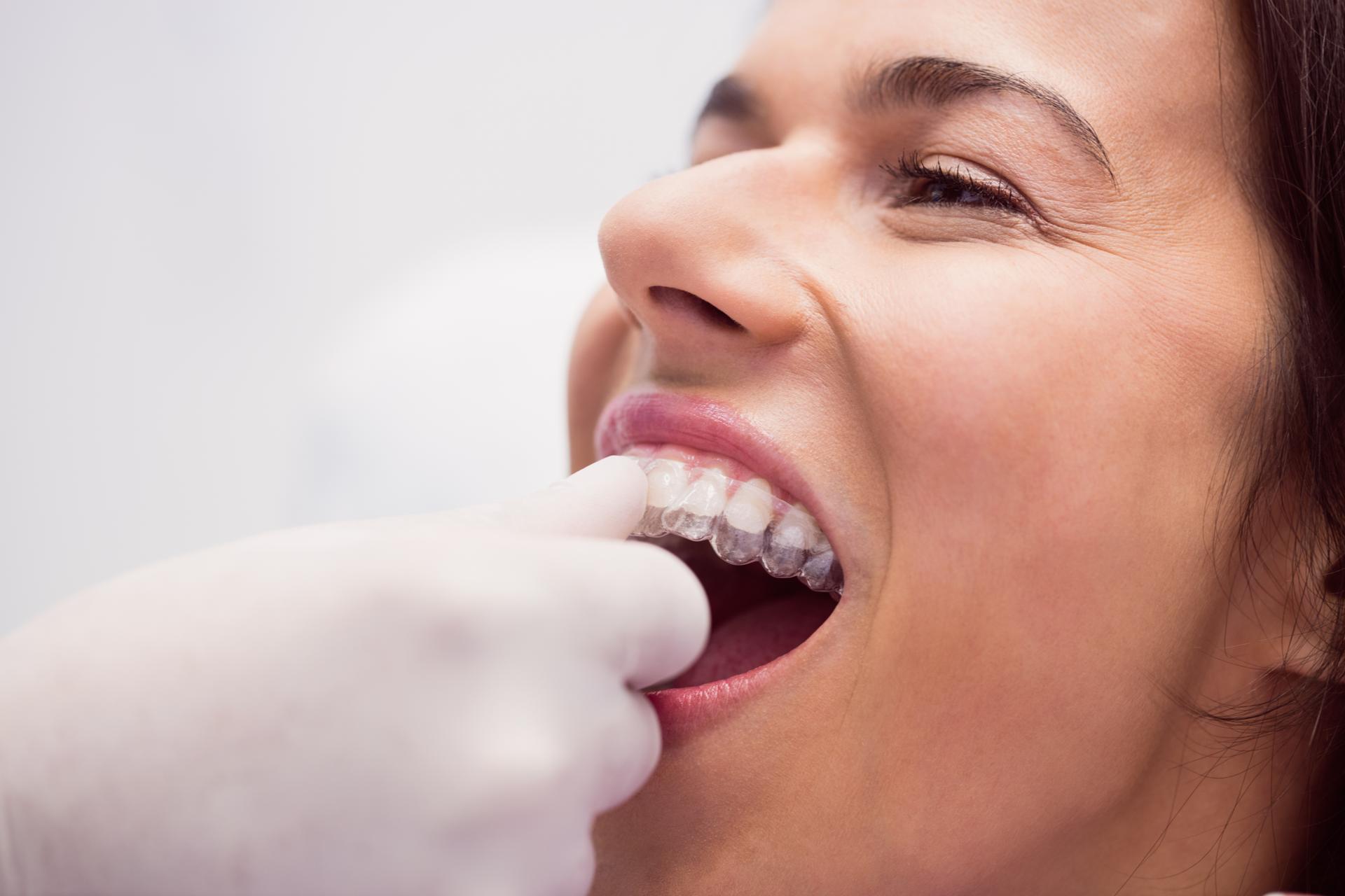 Dentist assisting female patient wearing braces